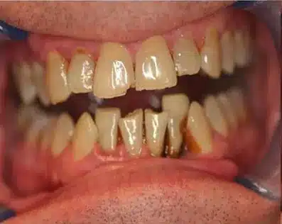 Dentist in Rancho Bernardo San Diego
