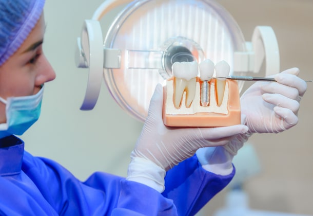 Dentist showing dental implant model